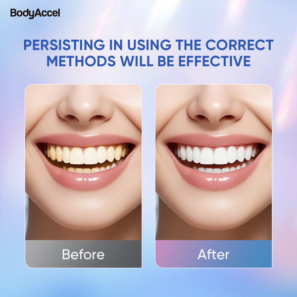 BodyAccel Teeth Whitening Strips