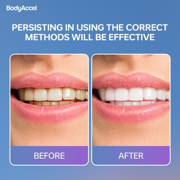 BodyAccel Brightening Toothpaste Tablet