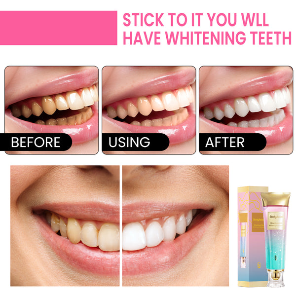 BodyAccel Niacinamide Whitening Toothpaste