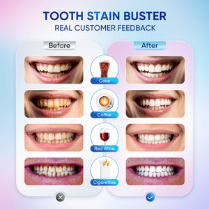Dentifrice blanchissant BodyAccel à la niacinamide
